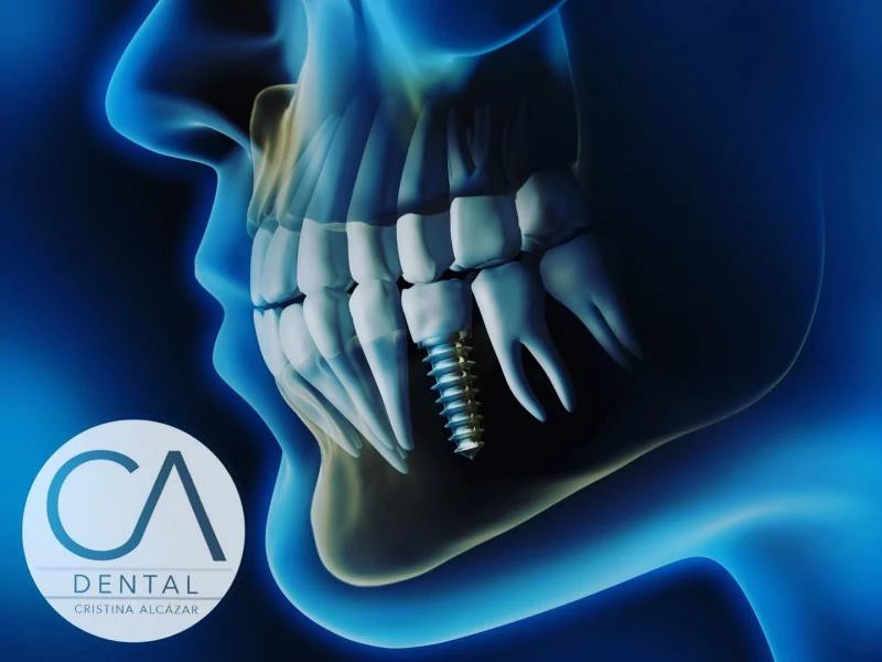 Odontología General en CA Dental