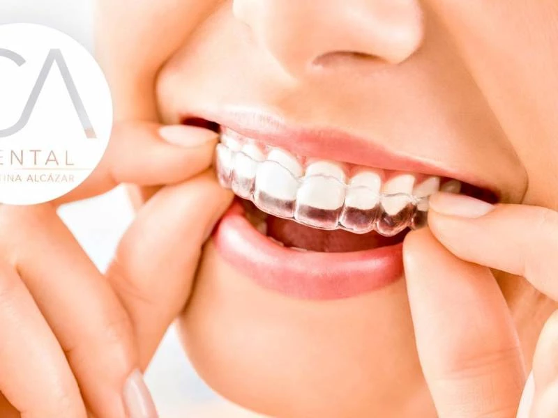 Ortodoncia invisible en CA Dental