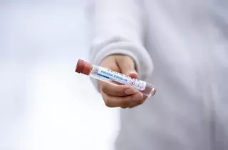 Datos actualizados del número de contagios por Covid19 en Las Rozas