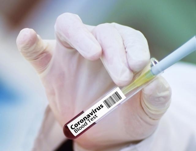 Continúa aumentando el número de casos de coronavirus en Las Rozas