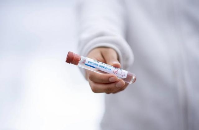 Se ralentiza el número de contagios por coronavirus en Las Rozas esta semana
