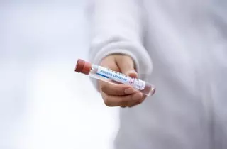 Se ralentiza el número de contagios por coronavirus en Las Rozas esta semana