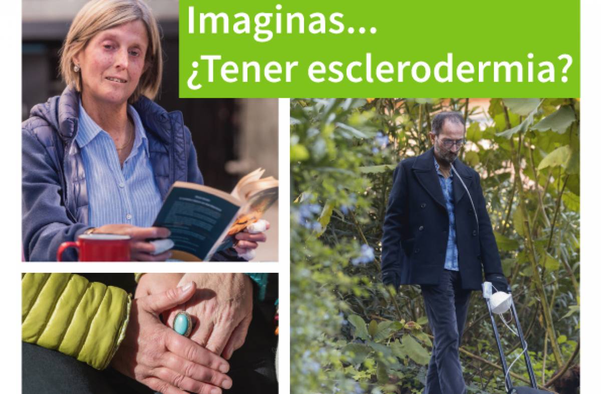 Las Rozas visibiliza la Esclerodermia