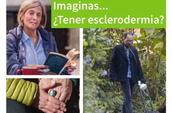 Las Rozas visibiliza la Esclerodermia